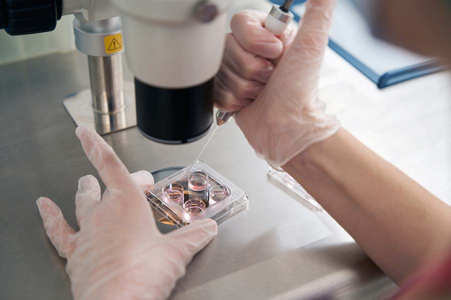 Doctor selects biomaterial with special syringe for subsequent manipulations Doctor selects biomaterial with special syringe for subsequent manipulations